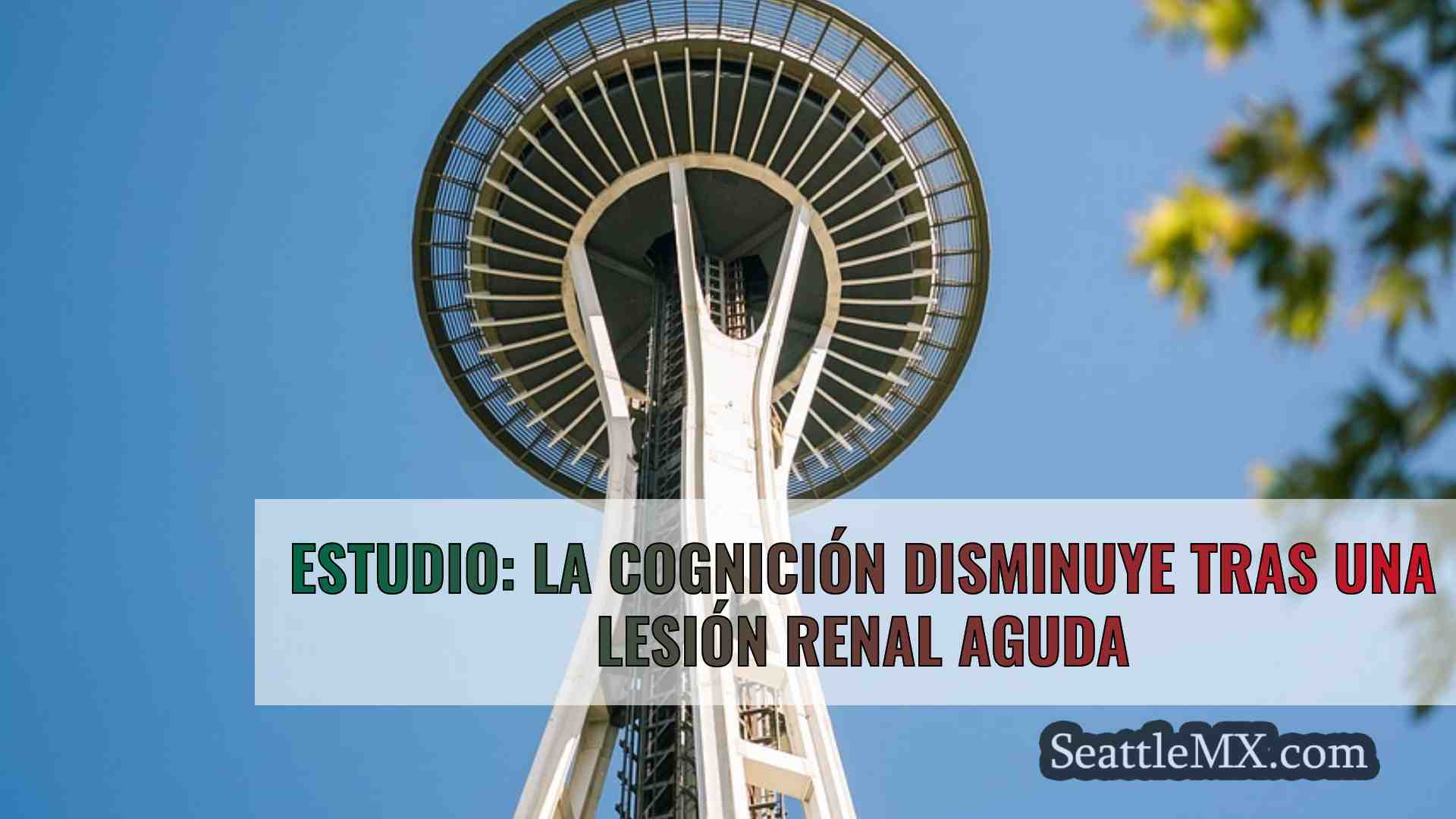 Noticias de Seattle SeattleMX