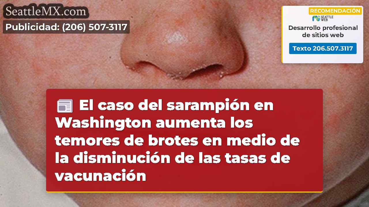 El caso del sarampión en Washington aumenta los