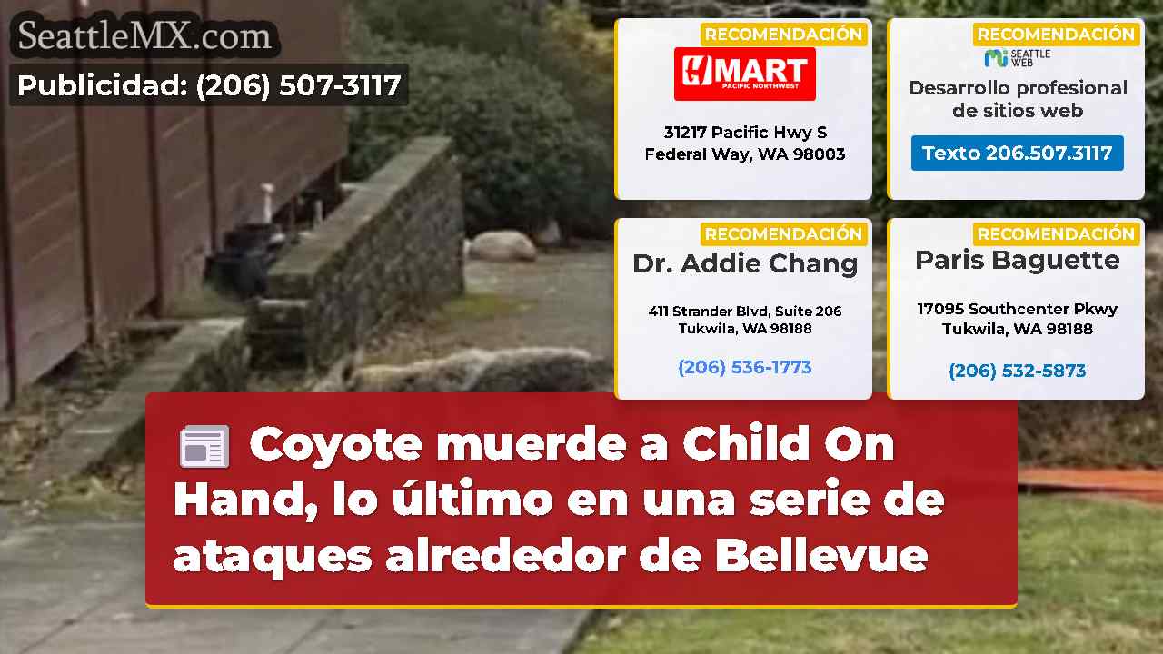 Coyote muerde a Child On Hand, lo último en una