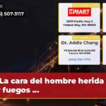 La cara del hombre herida por fuegos …