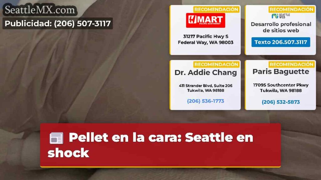 Pellet en la cara: Seattle en shock