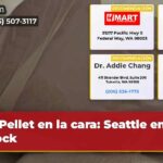 Pellet en la cara Seattle en shock