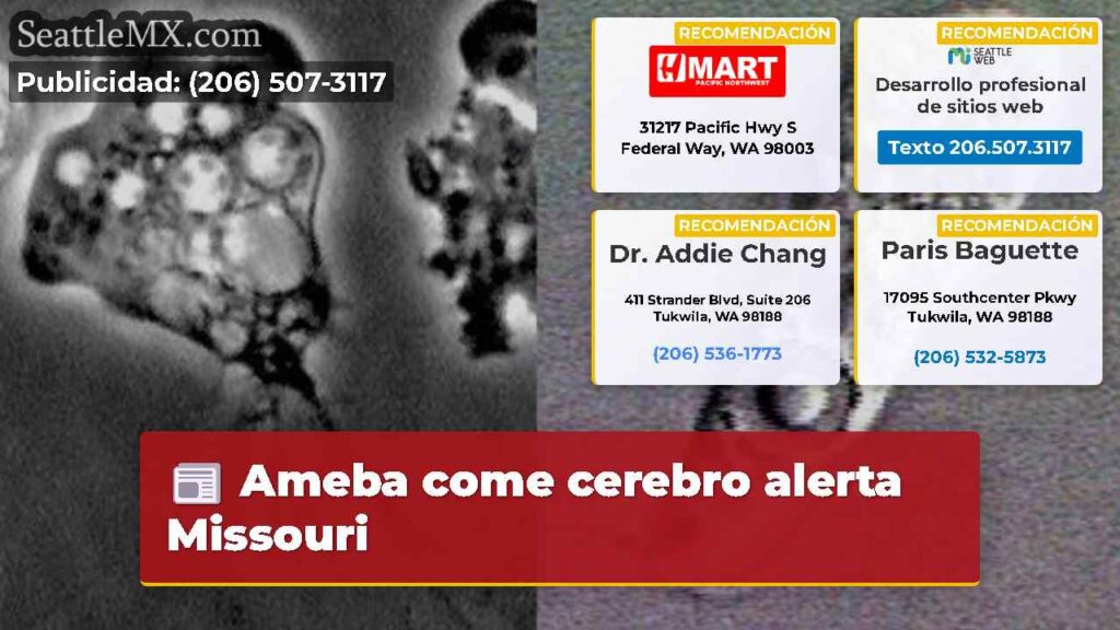 Ameba come cerebro alerta Missouri