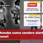 Ameba come cerebro alerta Missouri