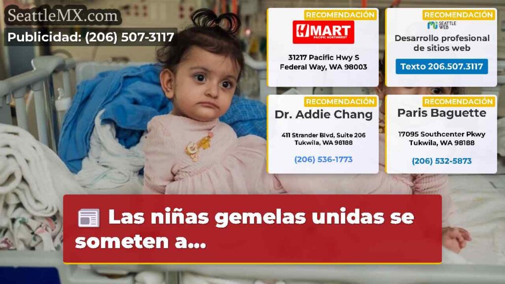 Las niñas gemelas unidas se someten a...