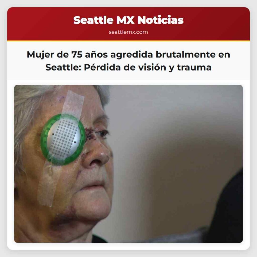 Mujer de 75 años agredida brutalmente en Seattle: