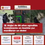 Mujer de 88 años en Seattle sufre agresión brutal le mordieron un dedo