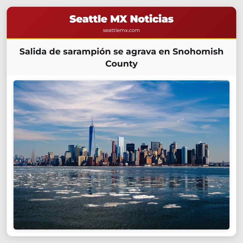 Salida de sarampión se agrava en Snohomish County