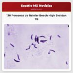 130 Personas de la Escuela Rainier Beach High School Serán Evaluadas por Tuberculosis