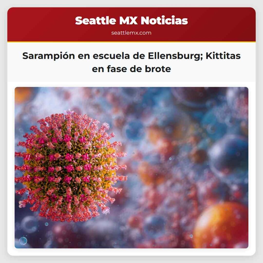 Sarampión en escuela de Ellensburg; Kittitas en