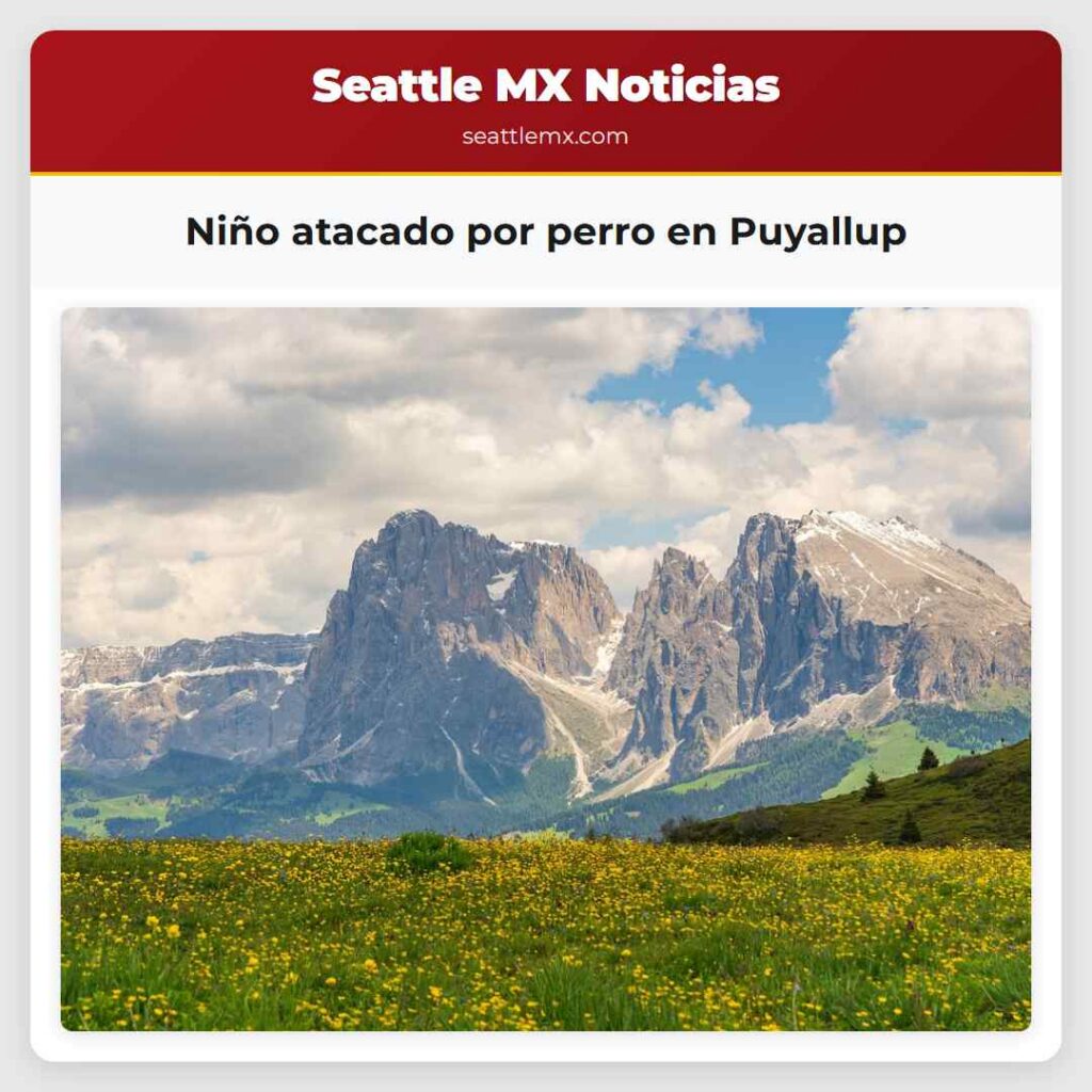 Niño atacado por perro en Puyallup