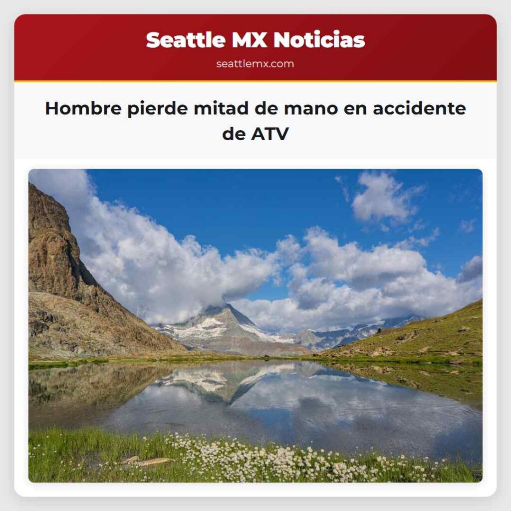 Hombre pierde mitad de mano en accidente de ATV